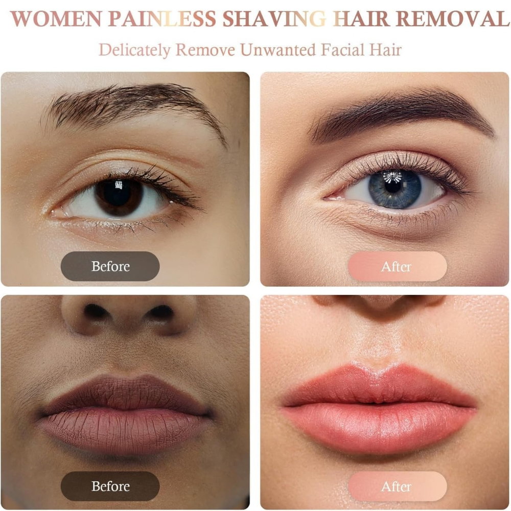 Epilator Facial Portabil, Indepartare Fina a Parului Nedorit [15]