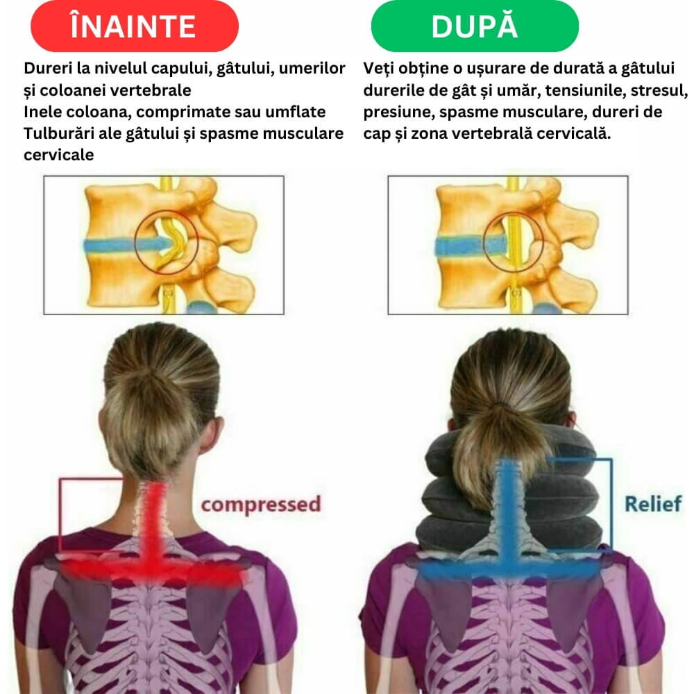 Guler cervical moale si gonflabil pentru Spondiloza si Hernie Cervicala [7]