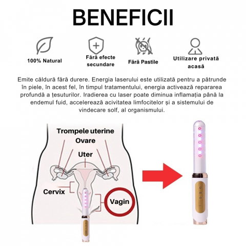 Bagheta Ginecologica cu Laser si Vibratii pentru Sanatatea Vaginala [19]