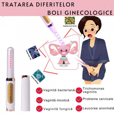 Bagheta Ginecologica cu Laser si Vibratii pentru Sanatatea Vaginala [26]