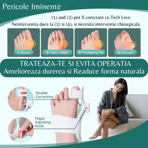 Corector Monturi TENICORE, pentru Corectarea, Tratarea si Îndreptarea degetelor la picioare, Dubla Corectie la Hallux Valgus [6]