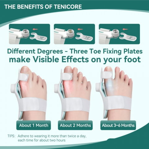 Corector Monturi TENICORE, pentru Corectarea, Tratarea si Îndreptarea degetelor la picioare, Dubla Corectie la Hallux Valgus [8]