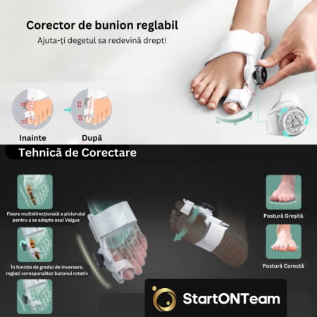 Corector Monturi Hallux Valgus Ajustabil – Deget [23]