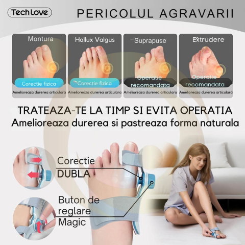 Corector de monturi Tech Love pentru femei si barbati [2]