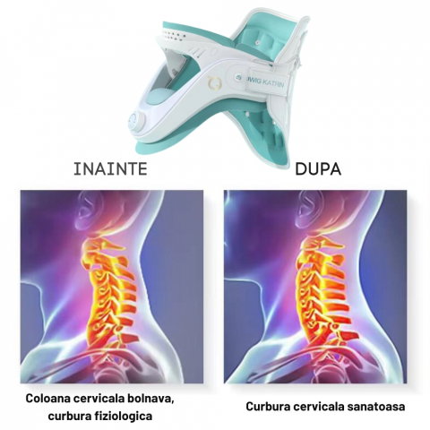 Guler Cervical pentru Spondiloza si Hernie Cervicala [16]