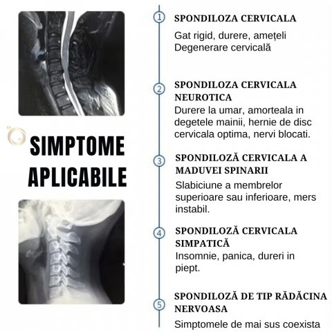 Guler Cervical pentru Spondiloza si Hernie Cervicala [17]