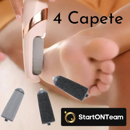 Set 4 Capete pentru Pila Electrică de Îngrijire a Călcâielor Crăpate - 2 Fine și 2 Grosiere [3]