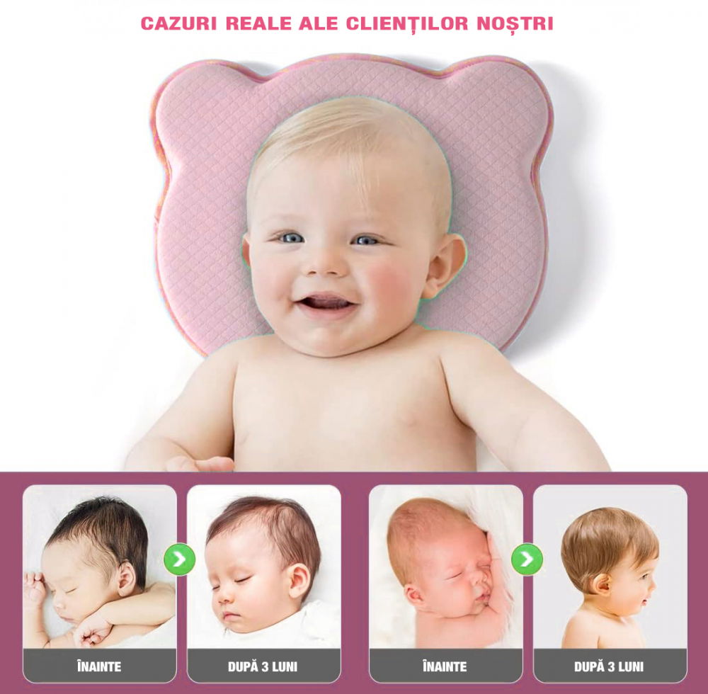 Perna bebelusi FiGGA® pentru formarea capului, Anti Plagiocefalie, Spuma cu memorie, Husa de protectie, Roz [6]