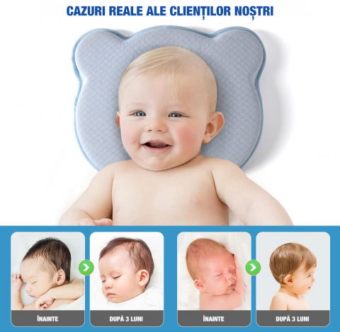 Perna bebelusi FiGGA® pentru formarea capului, Anti Plagiocefalie, Spuma cu memorie, Husa de protectie, Albastru [5]