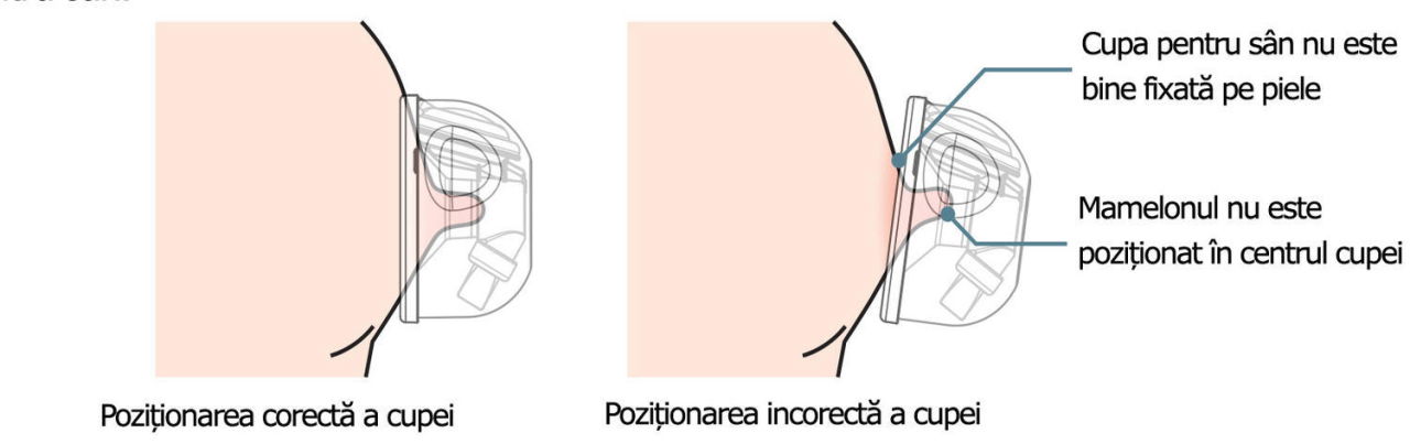 Set Cupe Hands Free (28 mm) [5]