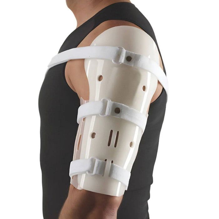 Orteza pentru fractura de humerus tip Sarmiento [1]